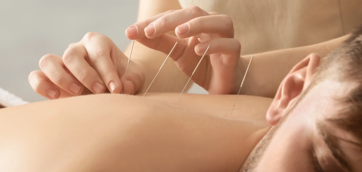 Acupuncture, Need a new company website?: earn money online, building a small business website, web building sites, free website builder, Free Company Website, small business website, website design, website builder, Free Website, starting a business, Square Space